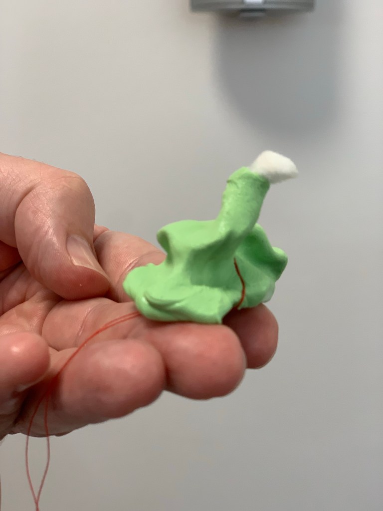 Abdruck meines linken Innenohrs in der Hand des Akustikers.