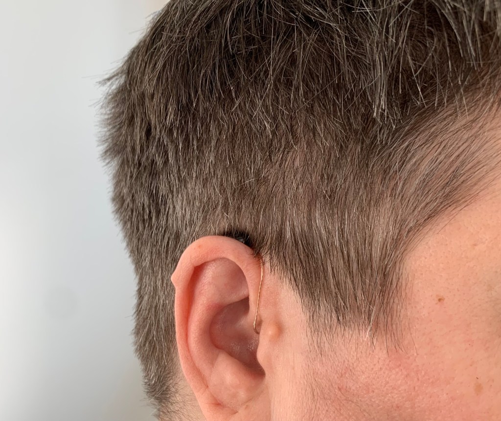 Mein rechtes Ohr mit einem anthrazitrabenem Schatten dahinter, der aber das Hörgerät ist. Von dort geht ein kaum sichtbares Kabel vor dem Ohr runter ins Ohrloch rein.